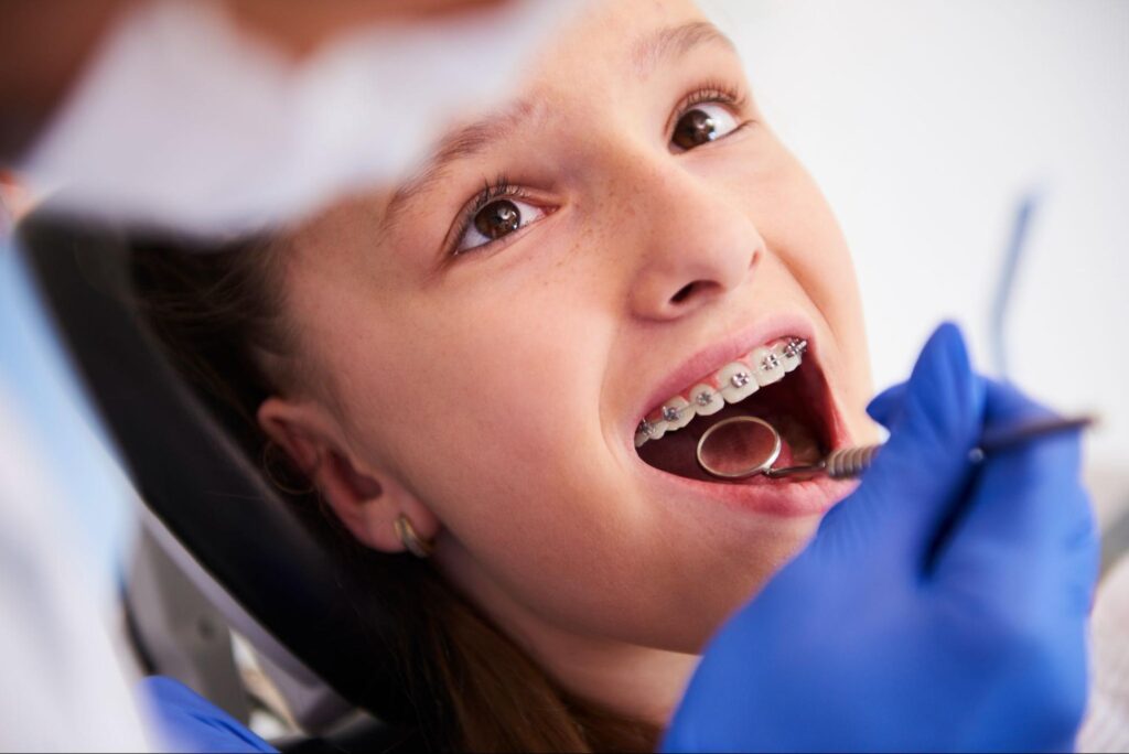 Why Early Orthodontic Evaluations Matter
