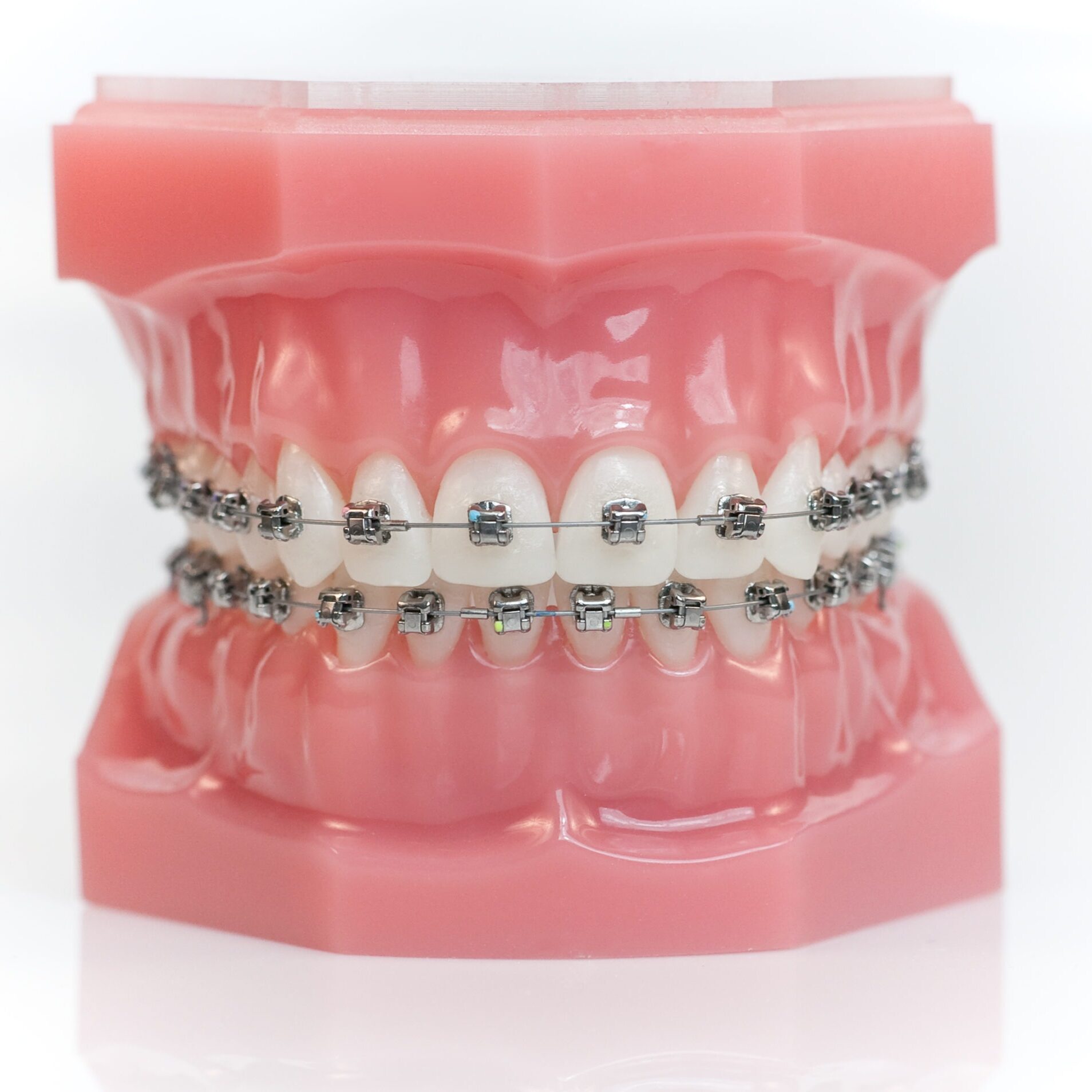 citrus heights braces